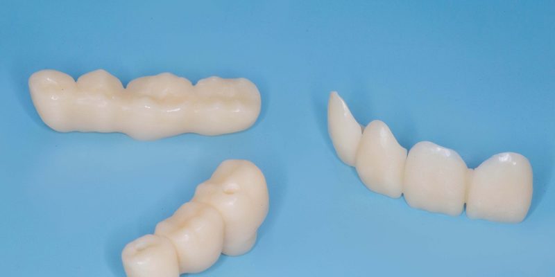 Пластмассовые коронки Томск Чепалова восстановление костной зубов